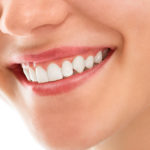 De belles dents blanches et saines